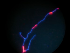A fungal hyphae.  Dead or inactive parts are stained with blue dye that colours cellulose, active or alive parts are stained with red dye that colours RNA