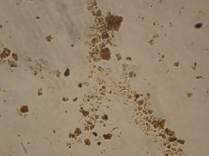 A fungal hyphae as seen through a normal microscope. You can't see the hyphae, only the soil particles that it has collected (image by An Vos)